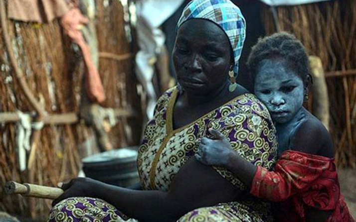 Nijerya'da 59 bin çocuk içtikleri su yüzünden öldü
