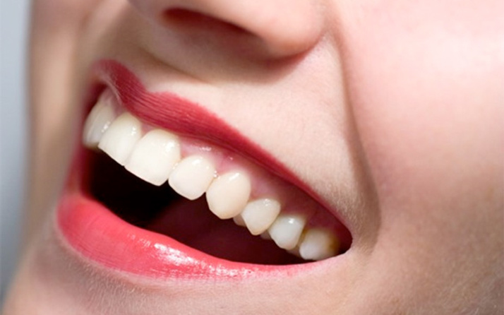 Hospitadent dişler için en zararlı 10 şeyi açıkladı