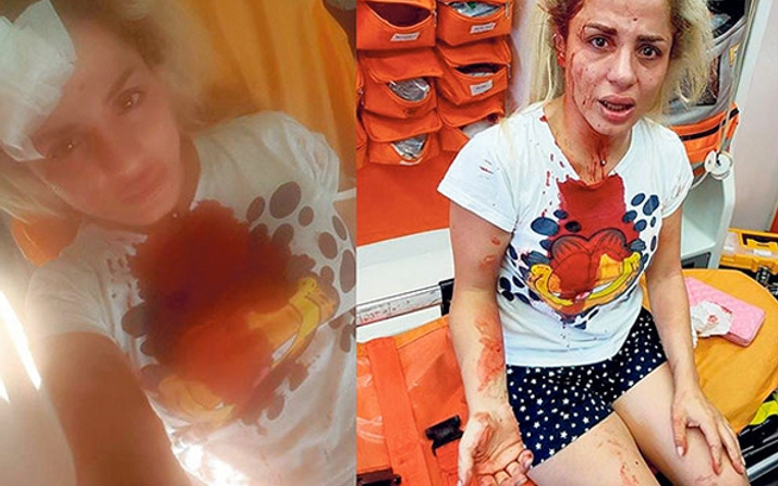 Şortlu kadını önce taciz etti ardından da sokakta dövdü