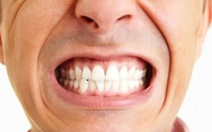 Diş sıkma probleminin tedavisi nasıl yapılır tehlikesi var mıdır?