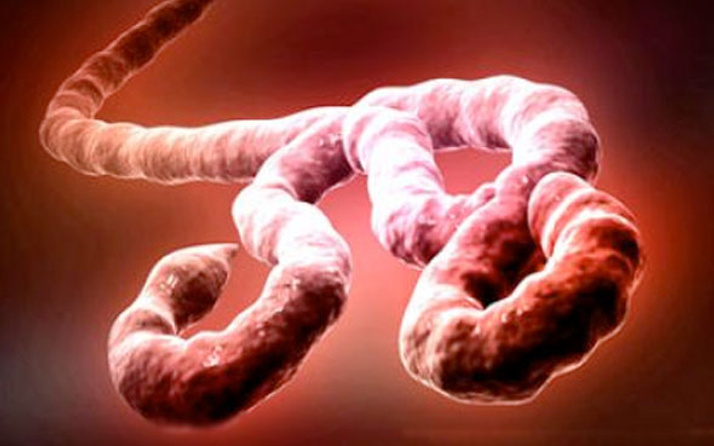 Ebola can almaya devam ediyor sayı 405'e yükseldi