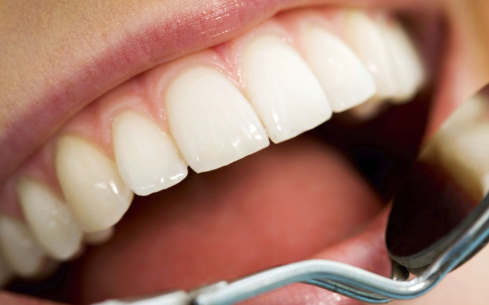 Diş sararmalarını önleyen Block Out yöntemi nedir?