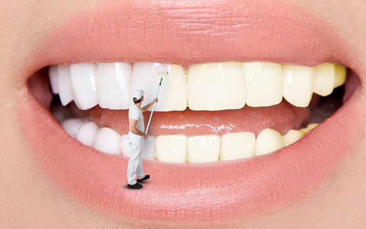 Diş beyazlatmak kanser yapar mı? Uzmanlar net konuştu