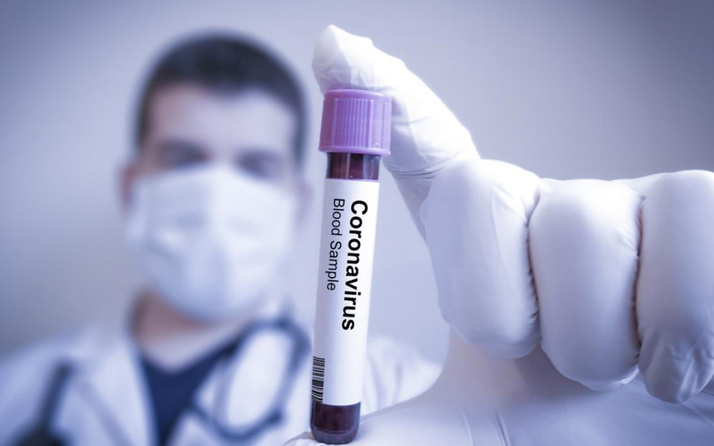 ABD için korkutan koronavirüs tahmini!