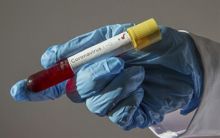 Dünya genelinde koronavirüsü atlatanların sayısı 38 milyonu geçti