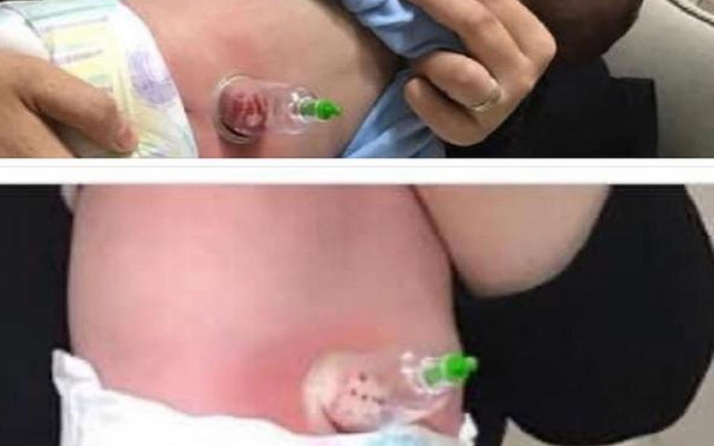 Bebeklere 'hacamat' görüntüleri tartışma yarattı! Uzmanından uyarı
