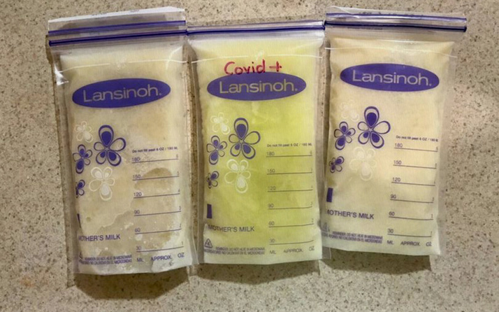 Meksika'da koronavirüse yakalanan annenin sütü yeşile döndü