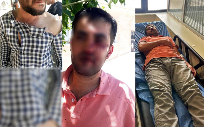 Mardin'de kaçak ihbarına incelemeye giden elektrik dağıtım ekibine saldırı