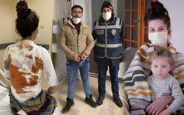 Konya'da eşiyle kızını kaynar suyla haşladı! Sözleri pes dedirtti: Aldığı ceza şaşırttı