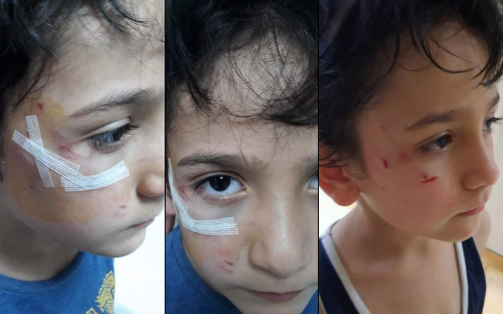Bursa'da 8 yaşındaki çocuk yolda dehşeti yaşadı! Feci halde yaralandı