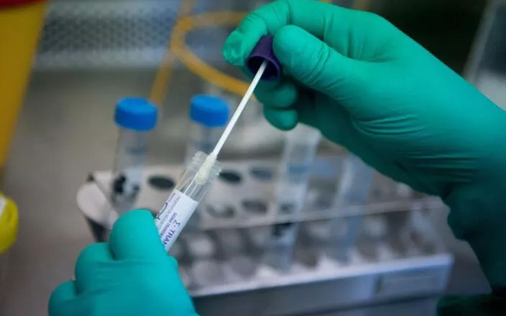 Covid-19 PCR testlerinde varyant endişesi! Bilim Kurulu Üyesi Kayıpmaz açıklık getirdi