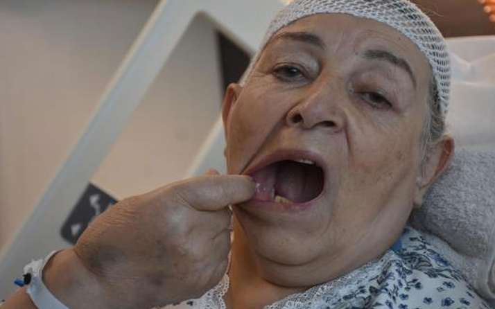 İzmir'de 'delirten hastalık'ta 5 dişinden oldu! Elini yüzüne değdiremiyor