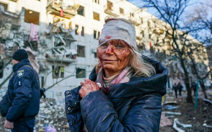Rusya-Ukrayna savaşının simgesi oldu dünyanın konuştuğu yaralı kadın bakın ne dedi?