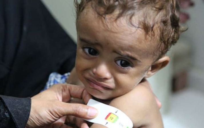 85 bin bebek açlıktan hayatını kaybetti Yemen kan ağlıyor