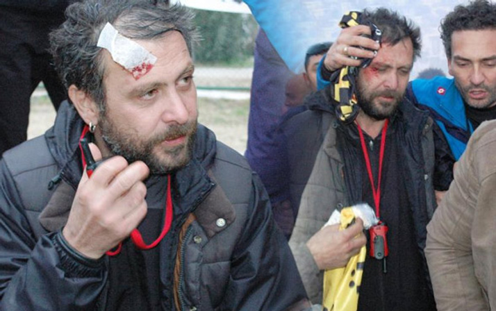 Nejat İşler saldırıya uğradı dişi kırıldı bayılıp kaldı daha sonra...