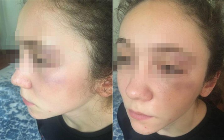 'Antrenör, 14 yaşındaki milli karateciyi yumrukla dövdü' iddiası