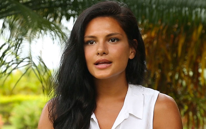 Survivor Almeda'nın inanılmaz değişimi! Estetikle bambaşka birine dönüştü