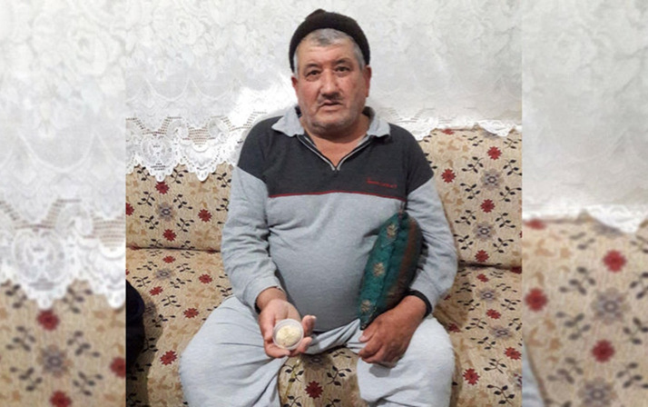 Mesanesinden çıkan doktorları bile şoke etti! Tam 300 gr ve...