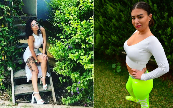 22'nci kez estetik ameliyatı oldu kadınlara mesaj yolladı