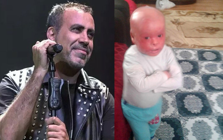 Haluk Levent mutlu haberi verdi! Balık pulu hastası olan Küçük Emir için umut oldu