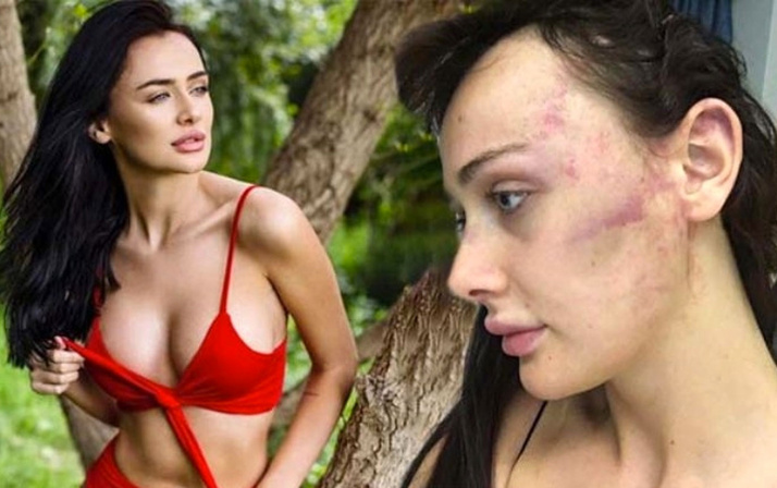 Türk sevgilisinden 7 saat şiddet gören Sırp Model Tanja Djukic'ten dehşete düşüren ifadeler!