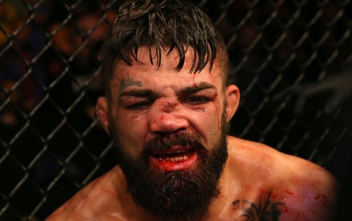 Mike Perry'nin burnu kırıldı suratı tanınmaz hale geldi