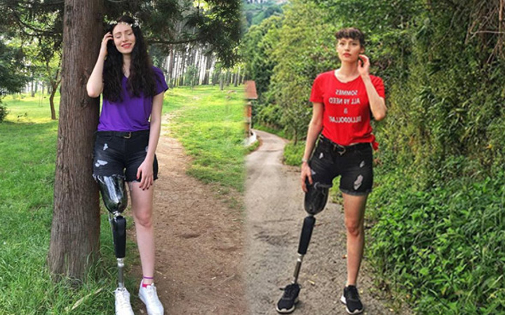 Kanser ondan bacağını almıştı Neslihan Tay 3. kez kansere yakalandı!