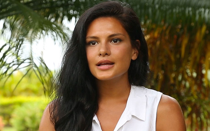 Survivor Almeda'nın inanılmaz değişimi! Estetikle bambaşka birine dönüştü