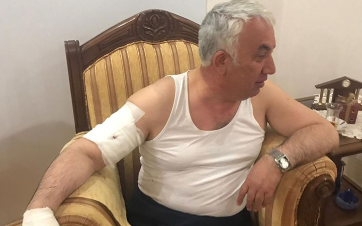 Belediye Başkanına korkunç köpek saldırısı kolunu parçaladı
