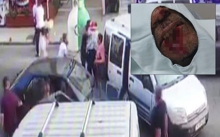 Pendik'te ısırarak kayınpederinin dudağını parçalayan damat tutuklandı