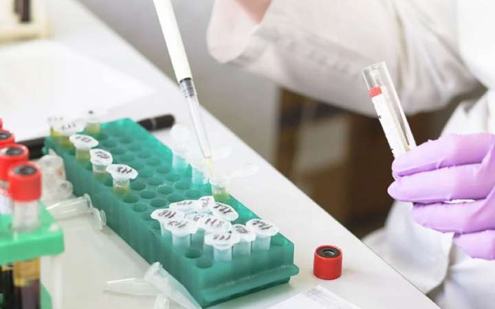 Ve sonunda! AstraZeneca koronavirüs aşısının üretimine başlıyor