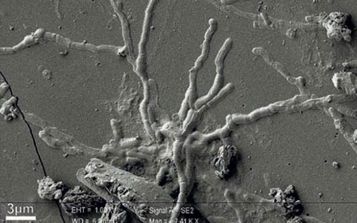 İtalya’da 2 bin yıl önceye ait kafatasından sağlam beyin hücresi keşfedildi
