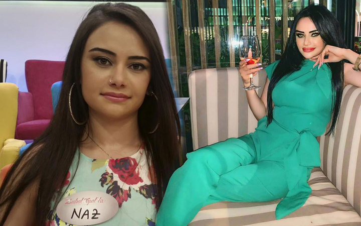 Eski gelin adayı Naz Mila sansürsüz kalça estetiğini yayımladı şoke etti