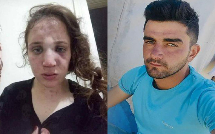 Aydın'da akılalmaz işkence! 3 çocuk annesi kadını bu hale getirdi!