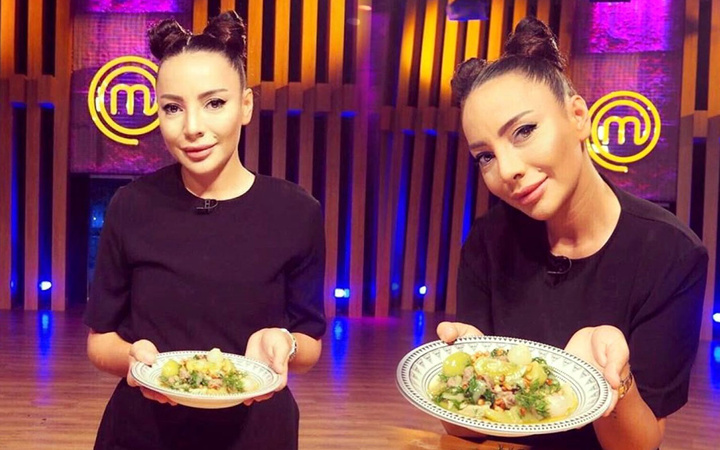 MasterChef Suna Aydın 'ufak dokunuşlar' dedi ama estetikli halini gören şaştı kaldı