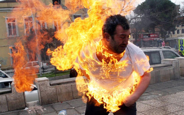 Samsun'da dehşet fotoğraftaki kişi konuştu olayın yaşandığı caddeden geçemiyor