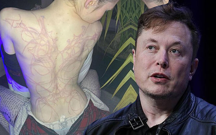 'Çok acıdı' deyip anlattı! Elon Musk'un sevgilisi Grimes'in sırtını bu halde gören şok oldu