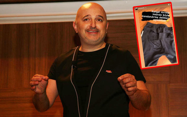 Yavuz Seçkin kangal köpeklerin saldırısına uğradı yaşadıklarını böyle anlattı
