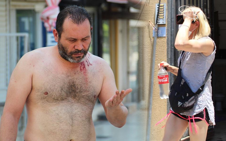 Antalya'da dehşeti yaşatıp kanlar içinde bıraktı! Trans kadın kendini eve kilitledi
