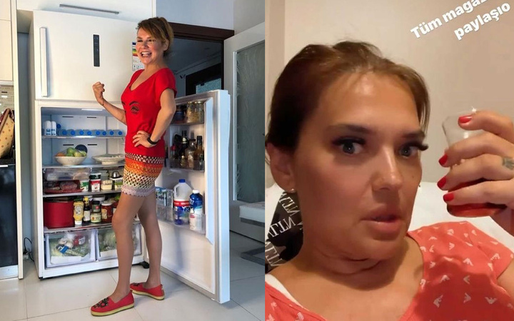 Deniz Seki Photoshop yüzünden ti'ye alındı, zayıflık sırrı 'Buz terapisi' imiş!