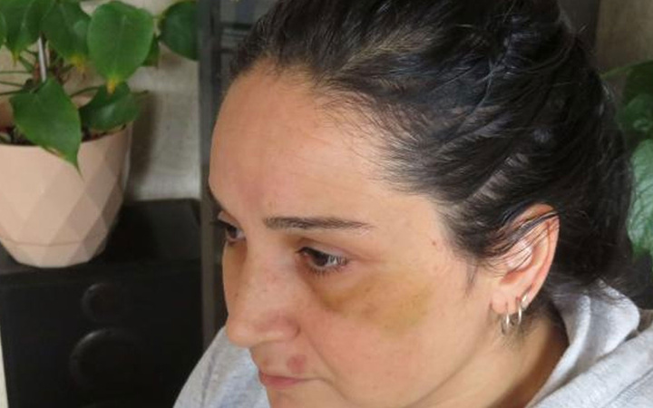 Üsküdar'da boşanma davası açtığı kocası kabusu yaşattı! Darbetti, otomobilini yaktı, tehdit etti