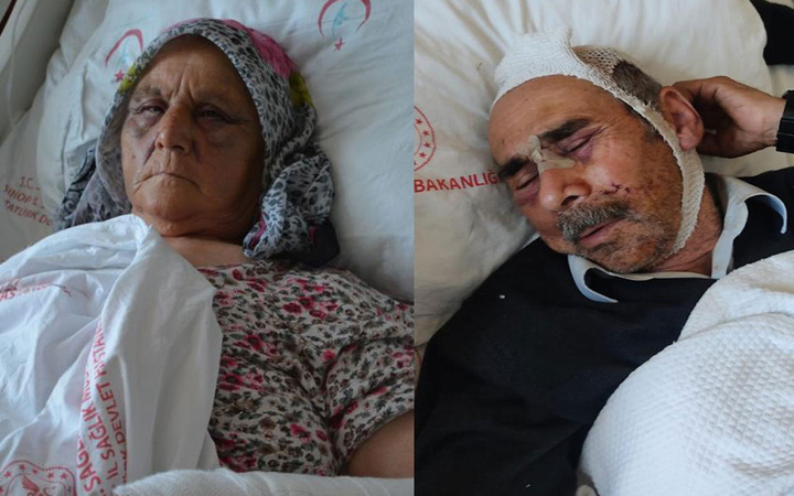 Olmaz olsun böyle evlat! İki saat boyunca işkence etti, anne ve babasını bu hale getirdi