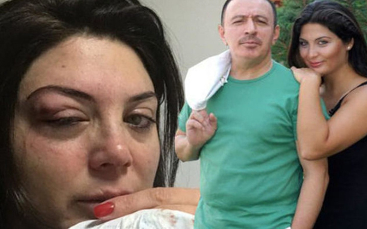 Mustafa Topaloğlu'nun eşinden kötü haber geldi! Duyanlar hastaneye koştu!