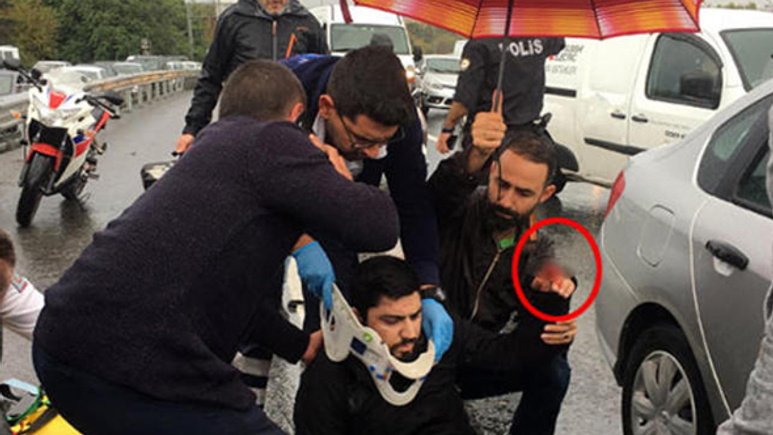 Korkunç kaza! Motosiklet sürücüsünün parmağı koptu