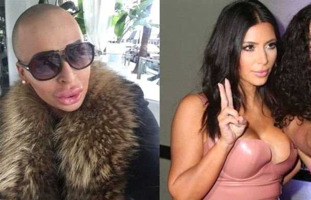 Kim Kardashian'a benzemek için servet harcadı sonuç...