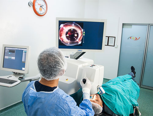 Femtosaniye lazerle katarakt ameliyatı nedir?