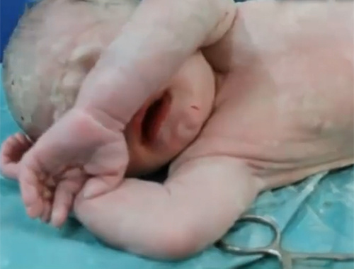 Yeni doğan bebek eroin krizine girdi