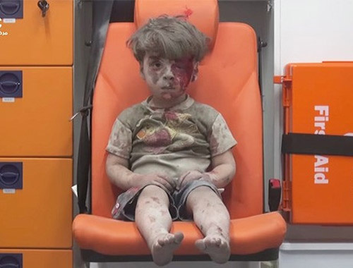 Ümran bebek bombardımanda ağır yaralı iddiası