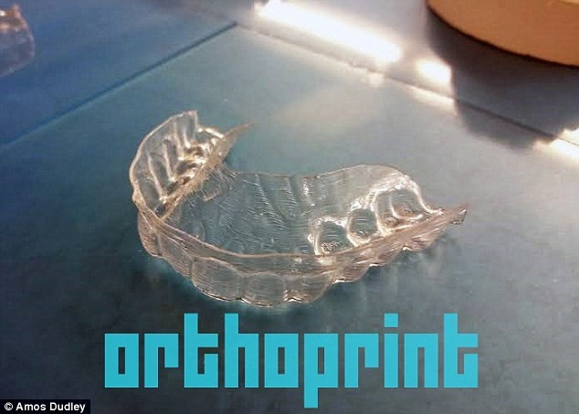 3D yazıcı ile dişlerini düzeltti