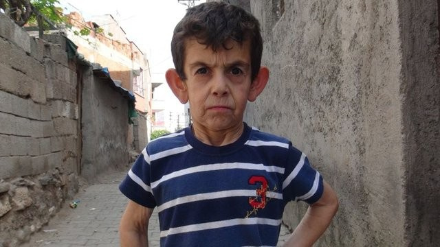 8 yaşındaki Mehmet'in yürek burkan dramı
